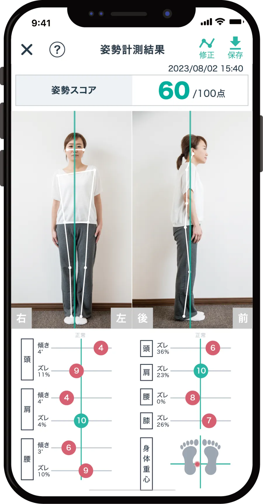 AI姿勢分析アプリ BODY Alignmet (ボディアライメント) 姿勢分析結果画面