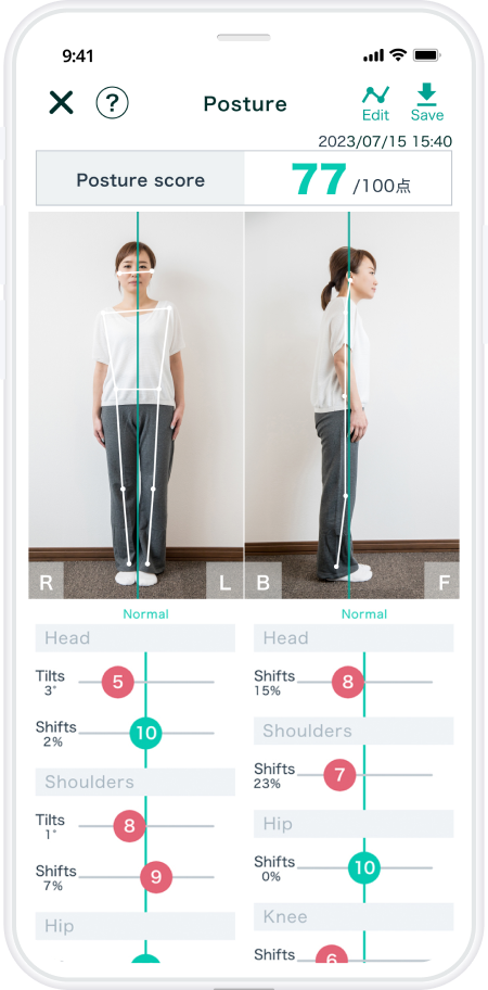 AI姿勢分析アプリ BODY Alignmet (ボディアライメント) 姿勢分析結果画面