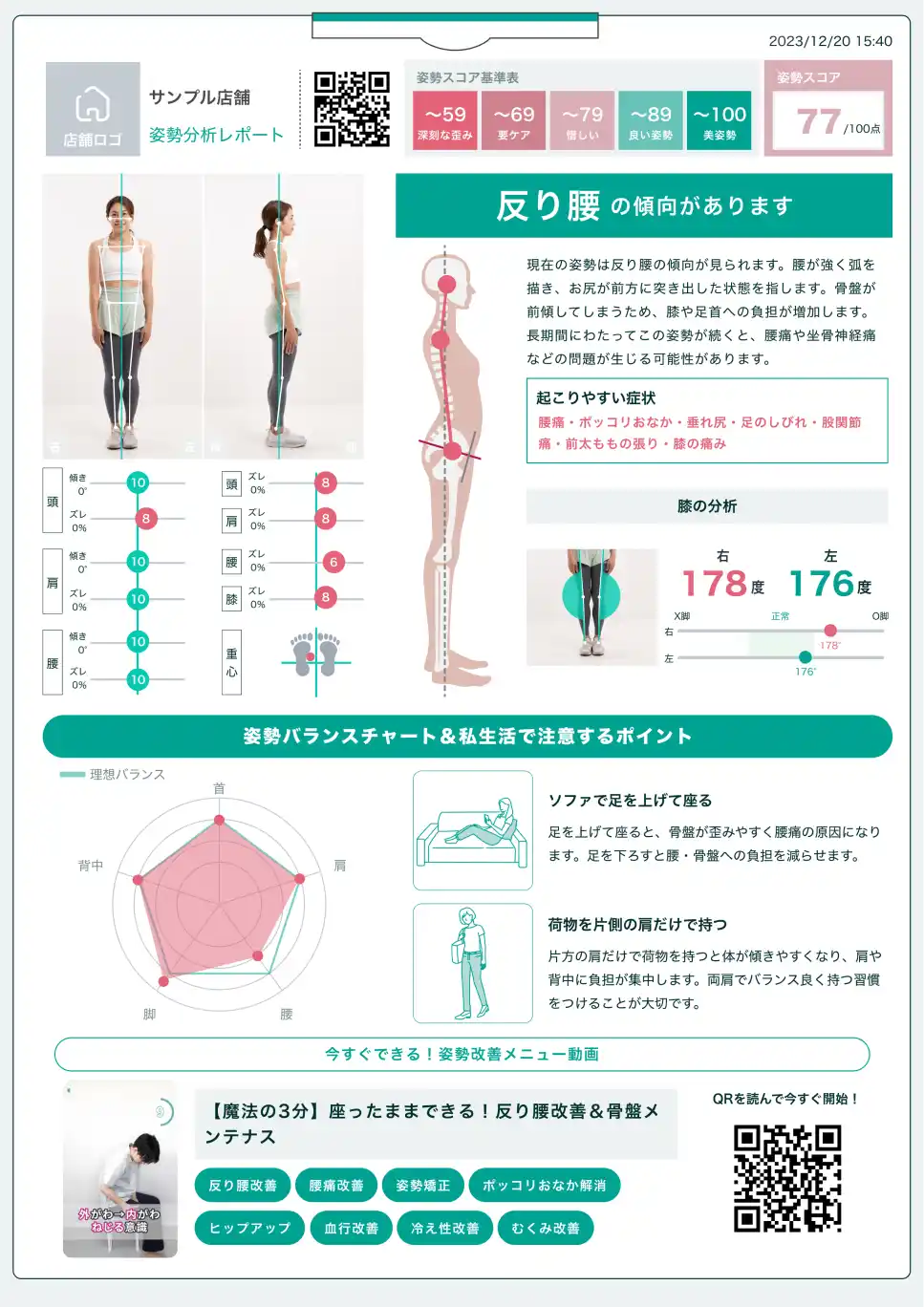 AI姿勢分析アプリ BODY Alignmet (ボディアライメント) 分析レポート